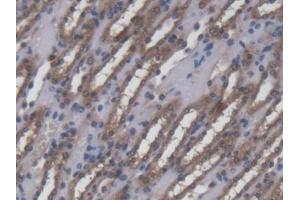 DAB staining on IHC-P; Samples: Mouse Kidney Tissue (Ninein 抗体  (AA 1-153))