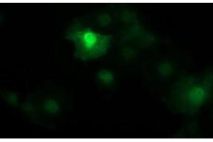 Image no. 2 for anti-Catenin (Cadherin-Associated Protein), beta 1, 88kDa (CTNNB1) antibody (ABIN1496898) (CTNNB1 抗体)