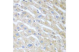 Immunohistochemistry of paraffin-embedded human liver using UCHL3 antibody. (UCHL3 抗体  (AA 1-220))