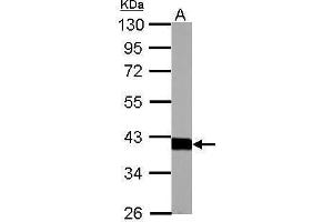 WB Image Aldolase B antibody detects ALDOB protein by Western blot analysis. (ALDOB 抗体)