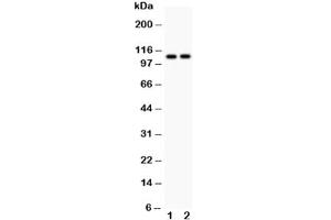 Western blot testing of ATP2A1 antibody and Lane 1:  rat skeletal muscle (ATP2A1/SERCA1 抗体  (N-Term))