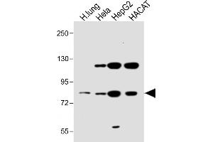 All lanes : Anti-SLC6A14 Antibody (C-term) at 1:1000 dilution Lane 1: Human lung lysate Lane 2: Hela whole cell lysate Lane 3: HepG2 whole cell lysate Lane 4: HACAT whole cell lysate Lysates/proteins at 20 μg per lane. (Slc6a14 抗体  (C-Term))