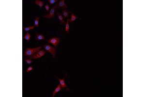 ABIN6274061 staining NCI-H1299 cells by ICC/IF. (Dynamin 1-Like 抗体  (pSer637))