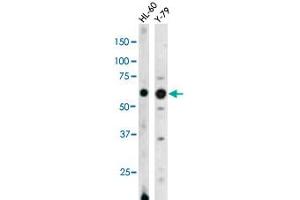 The RAD9A (phospho S328) polyclonal antibody  is used in Western blot to detect Phospho-RAD9A-S328 in HL-60 (left) and Y-79 (right) cell lysates (RAD9A 抗体  (pSer328))
