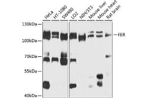 Western blot analysis of extracts of various cell lines, using FER antibody  at 1:1000 dilution. (FER 抗体  (AA 200-450))