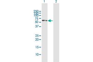 Western Blot analysis of STK33 expression in transfected 293T cell line by STK33 MaxPab polyclonal antibody.