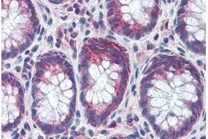 Human Colon (formalin-fixed, paraffin-embedded) stained with GATA6 antibody ABIN462170 followed by biotinylated goat anti-rabbit IgG secondary antibody ABIN481713, alkaline phosphatase-streptavidin and chromogen. (GATA6 抗体  (C-Term))