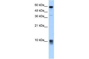 S100A3 antibody used at 5 ug/ml to detect target protein. (S100A3 抗体  (N-Term))