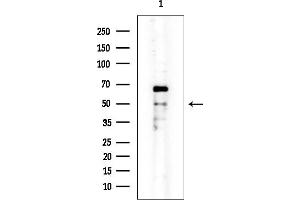 anti-Keratin 16 (KRT16) (C-Term) antibody