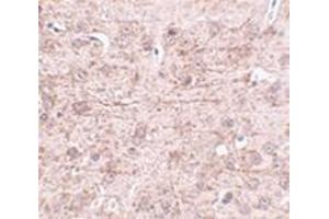 Immunohistochemistry of ZBTB1 in mouse brain tissue with this product at 2. (ZBTB1 抗体  (Center))
