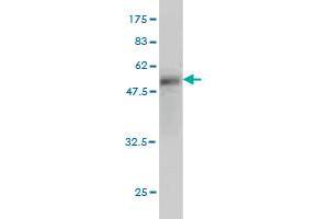 Western Blot detection against Immunogen (50. (WISP2 抗体  (AA 24-250))