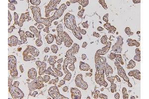 IHC analysis of EHD1 using anti-EHD1 antibody (ABIN6719599).