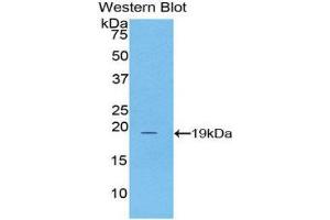 Western Blotting (WB) image for anti-Adrenoceptor alpha 1A (ADRA1A) (AA 330-466) antibody (ABIN1857926)