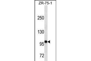 FUT4 Antibody (ABIN1539891 and ABIN2843850) western blot analysis in ZR-75-1 cell line lysates (35 μg/lane). (CD15 抗体  (AA 425-454))