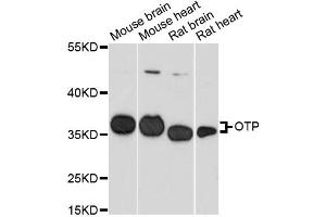 Western blot analysis of extracts of various cell lines, using OTP antibody. (OTP 抗体)