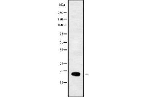 Western blot analysis of RPL29 using COLO205 whole cell lysates (RPL29 抗体  (Internal Region))