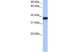WB Suggested Anti-GSG1 Antibody Titration: 0. (GSG1 抗体  (C-Term))