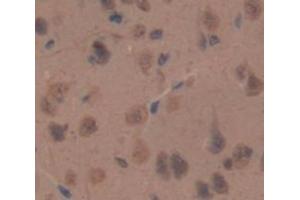 IHC-P analysis of Rat Tissue, with DAB staining. (NPPC 抗体  (AA 31-126))