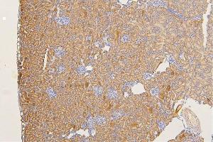 IHC analysis of SFRP1 using anti-SFRP1 antibody (ABIN6719484).