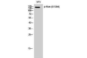 Western Blotting (WB) image for anti-Macrophage Stimulating 1 Receptor (C-Met-Related tyrosine Kinase) (MST1R) (pSer1394) antibody (ABIN3173035) (MST1R 抗体  (pSer1394))