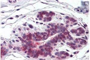 Anti-ELOVL5 antibody  ABIN960769 IHC staining of human breast. (ELOVL5 抗体  (Internal Region))