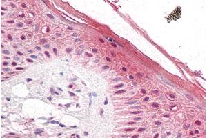 ABIN184855 (5µg/ml) staining of paraffin embedded Human Skin. (PUF60 抗体  (C-Term))