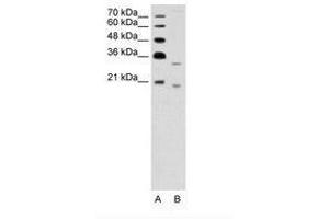 Image no. 1 for anti-Deoxyribonuclease II beta (DNASE2B) (AA 47-96) antibody (ABIN203437) (DNASE2B 抗体  (AA 47-96))