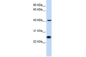 WB Suggested Anti-CDC25C Antibody Titration:  0.