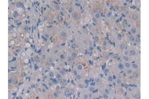 Detection of MCSF in Mouse Ovary Tissue using Polyclonal Antibody to Colony Stimulating Factor 1, Macrophage (MCSF) (M-CSF/CSF1 抗体  (AA 33-204))