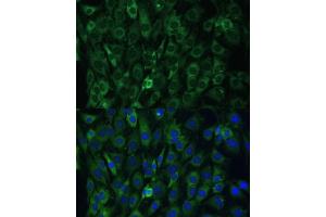 Immunofluorescence (IF) image for anti-Eukaryotic Translation Initiation Factor 3, Subunit D (EIF3D) (AA 1-240) antibody (ABIN6140057)