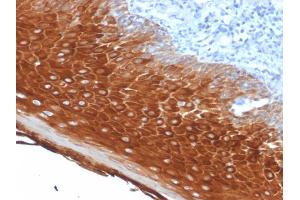 Immunohistochemistry (IHC) image for anti-Keratin 6A (KRT6A) antibody (ABIN6939867)