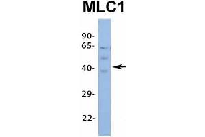 Host:  Rabbit  Target Name:  MLC1  Sample Type:  Human Fetal Spleen  Antibody Dilution:  1. (MLC1 抗体  (Middle Region))