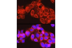 Immunofluorescence analysis of HepG2 cells using PYGL Rabbit pAb (ABIN6132277, ABIN6146525, ABIN6146526 and ABIN6222425) at dilution of 1:150 (40x lens). (PYGL 抗体  (AA 1-280))