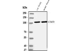 Western blot analysis of GABBR1 using anti-GABBR1 antibody (ABIN5518835).