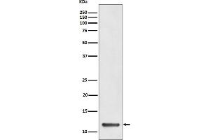 Western blot analysis of TCTEX1 expression in HeLa cell lysate.