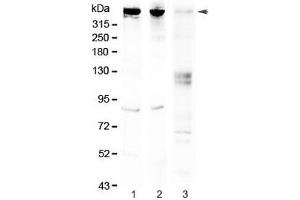 Western blot testing of 1) rat brain, 2) mouse brain and 3) human HeLa lysate with Sacsin antibody at 0. (Sacsin 抗体)