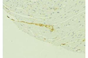 ABIN6276410 at 1/100 staining Mouse liver tissue by IHC-P.