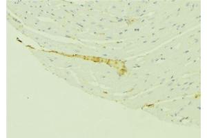 ABIN6276410 at 1/100 staining Mouse liver tissue by IHC-P. (VDAC1 抗体  (C-Term))