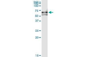 Immunoprecipitation of VRK2 transfected lysate using anti-VRK2 MaxPab rabbit polyclonal antibody and Protein A Magnetic Bead , and immunoblotted with VRK2 purified MaxPab mouse polyclonal antibody (B01P) . (VRK2 抗体  (AA 1-508))