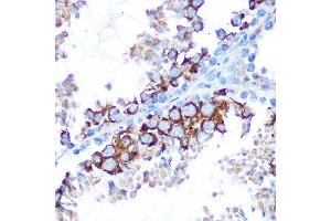 Immunohistochemistry (IHC) image for anti-Mitogen-Activated Protein Kinase Kinase Kinase 7 (MAP3K7) (AA 300-470) antibody (ABIN6143503)