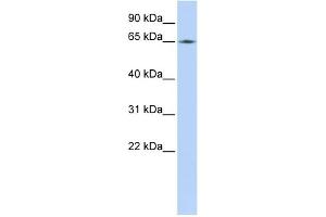 WB Suggested Anti-LMNB2 Antibody Titration:  0. (Lamin B2 抗体  (Middle Region))