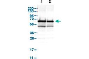 Western Blot analysis of (1) human cell line RT-4, and (2) human cell line U-251MG sp. (METAP2 抗体  (AA 10-101))