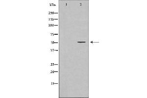 Western blot analysis of Hela whole cell lysates, using ADCYAP1R1 Antibody.