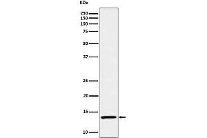 Western blot analysis of IL15 in Recombinant human IL-15 protein cell lysate.