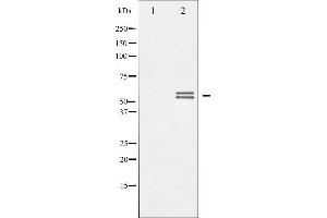 Western blot analysis of Lyn phosphorylation expression in H2O2 treated K562 whole cell lysates,The lane on the left is treated with the antigen-specific peptide. (LYN 抗体  (pTyr507))