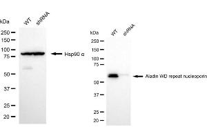 Western blotting analysis using aladin WD repeat nucleoporin antibody (ABIN7797447).