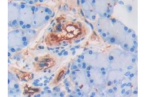 Immunohistochemistry (IHC) image for anti-Adiponectin (ADIPOQ) (AA 111-244) antibody (ABIN7432169)
