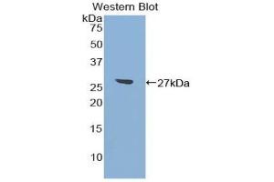 Detection of Recombinant ATF7, Mouse using Polyclonal Antibody to Activating Transcription Factor 7 (ATF7) (AFT7 抗体  (AA 50-270))
