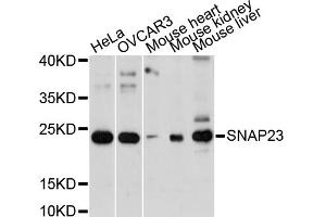 Western blot analysis of extracts of various cell lines, using SNAP23 antibody. (SNAP23 抗体)