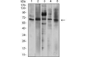 Western Blotting (WB) image for anti-Purinergic Receptor P2X, Ligand-Gated Ion Channel, 7 (P2RX7) (AA 226-452) antibody (ABIN5542663)